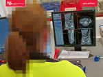 Funkcjonariuszka Służby Celno-Skarbowej siedzi przy monitorze komputera, na którym wyświetlane jest zdjęcie wyniku tomografii komputerowej zatrzymanej pasażerki. Na zdjęciu widać małe, owalne przedmioty wewnątrz przewodu pokarmowego zatrzymanej.